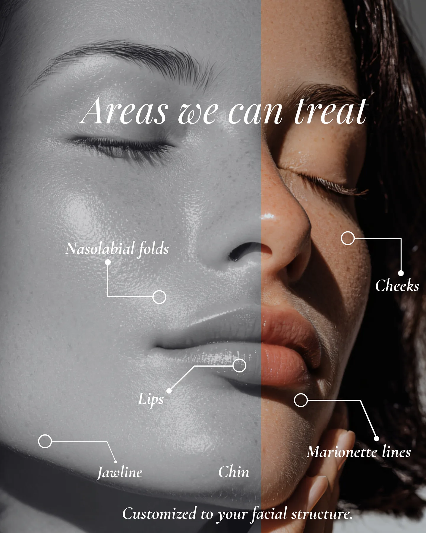 Areas we can treat — customized to your facial structure