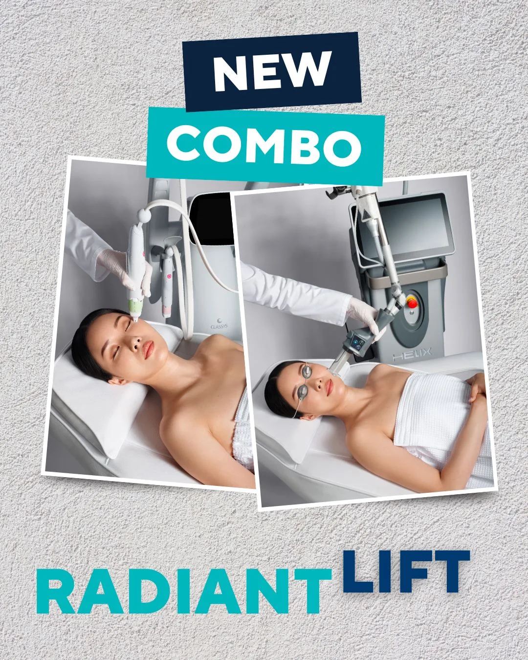 Radiant Lift — new combo: Everesse RF + CoolPeel CO₂